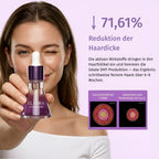 Elayra Cyperus Rotundus Serum